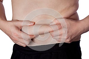 A fat man shows fat deposits on his stomach.