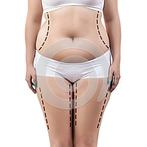 Fat woman with dotted lines on her body. photo