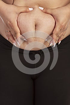 A fat woman grabs her belly with her hands