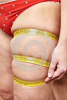 Fat woman measuring thigh leg tape measure