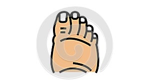 fatty foot edema color icon animation