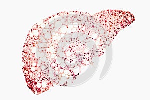 Fatty liver conceptual image