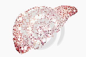 Fatty liver conceptual image photo