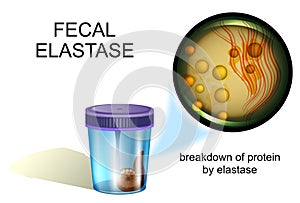 Fecal elastase. coprology