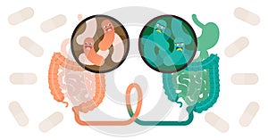 Fecal microbiota transplant FMT or stool transplant procedure concept