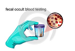 Fecal occult blood testing photo
