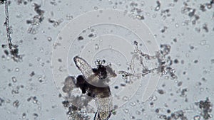 Feeding a large rotifer in fresh water microscopic background.