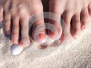 Painted toe nails