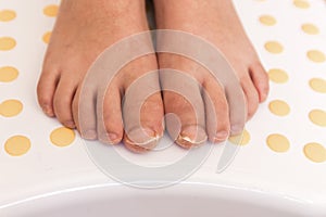 Feet with fungal toe nail infection