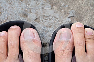 Feet of men wearing black sandals