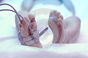 Feet of new born baby under ultraviolet lamp photo