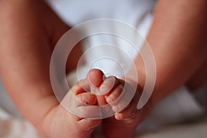 Feet of a newborn baby boy without socks clubfoot