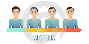 Female alopecia stages set.