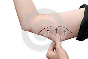female arm line about to perform liposuction photo