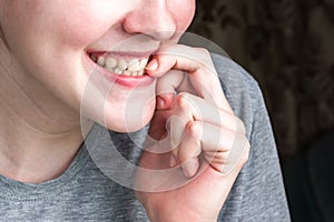 Female biting her nails.