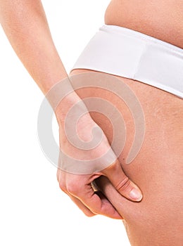 Female checking cellulite on her buttocks