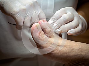 Female chiropodist working on a senior clients feet