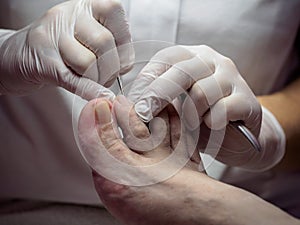 Female chiropodist working on a senior clients feet