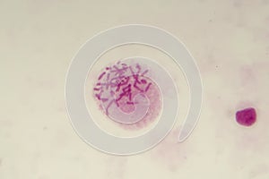 Female chromosomes inside the cell