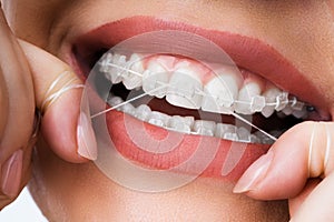 Female Cleaning Dental Brackets In Mouth photo