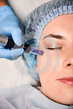 Female client having fractional mesotherapy in beauty salon. photo