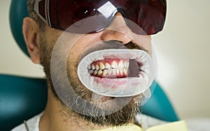 Female dentist checking patient teeth with mirror in modern dental clinic. Dentist comparing teeth whitening of her