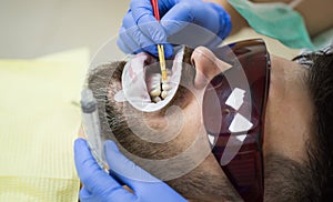 Female dentist checking patient teeth with mirror in modern dental clinic. Patient having dental checkup with