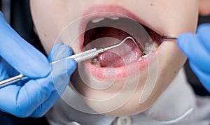 Female dentist examines the teeth of the patient child