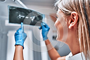 Female dentist examining x-ray at the dental clinic