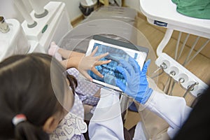 Female dentist explaining teeth x-ray to a little girl in dental clinic, teeth check-up and Healthy teeth concept