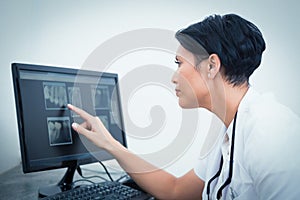 Female dentist looking at x-ray on computer