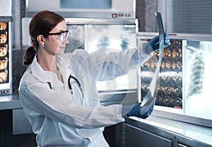 Female doctor check film x-ray image for patient medical care. Surgeon woman examining x-ray film of human body part then