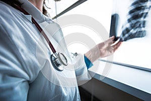 Female doctor checking xray image