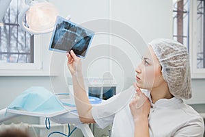 Female doctor dentist examining x-ray of human jaw