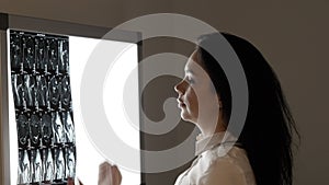 Female doctor examine magnetic resonance tomography image at screen