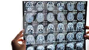 A female doctor examines an MRI scan of the brain.