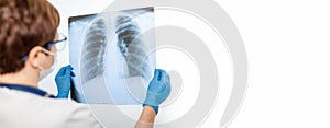 A female doctor examines an X-ray of a patient s lung infected with covid-19 coronavirus, pneumonia.X-rays of light. Fluorography