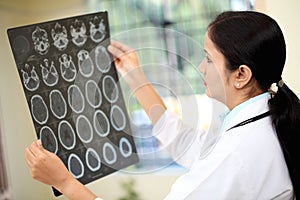 Female doctor examining a brain scan