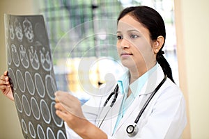 Female doctor examining a brain scan