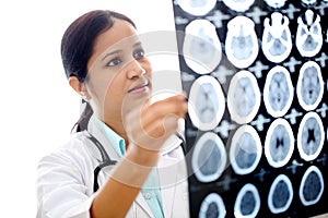 Female doctor examining a brain tomography scan