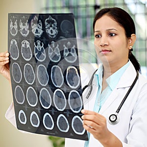Female doctor examining a brain tomography scan photo
