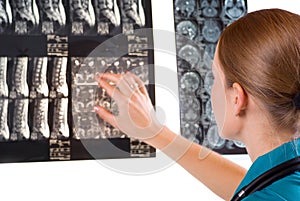 Female Doctor examining MRI image