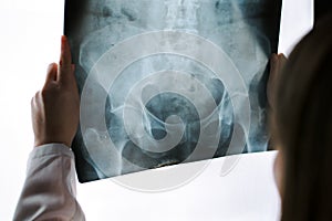 Female doctor examining pelvis x-ray in hospital office