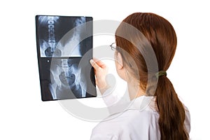 Female doctor examining an x ray