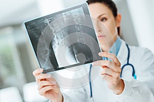 Female doctor examining an x-ray