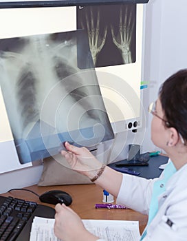 Female doctor examining an x-ray