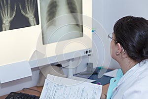 Female doctor examining an x-ray