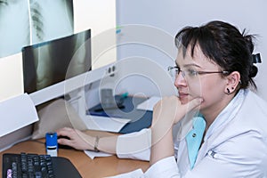 Female doctor examining an x-ray