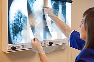 Female doctor examining x-ray images in hospital. She is wearing