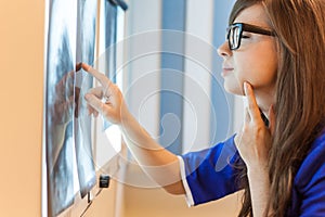 Female doctor examining x-ray images in hospital. She is wearing